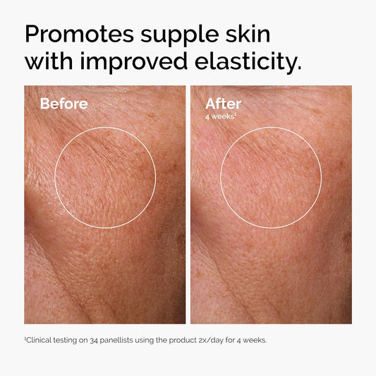 The Ordinary Hyaluronic Acid 2% + B5 (with Ceramides), Multi-Depth Hydration Serum for Plumper, Smoother Skin