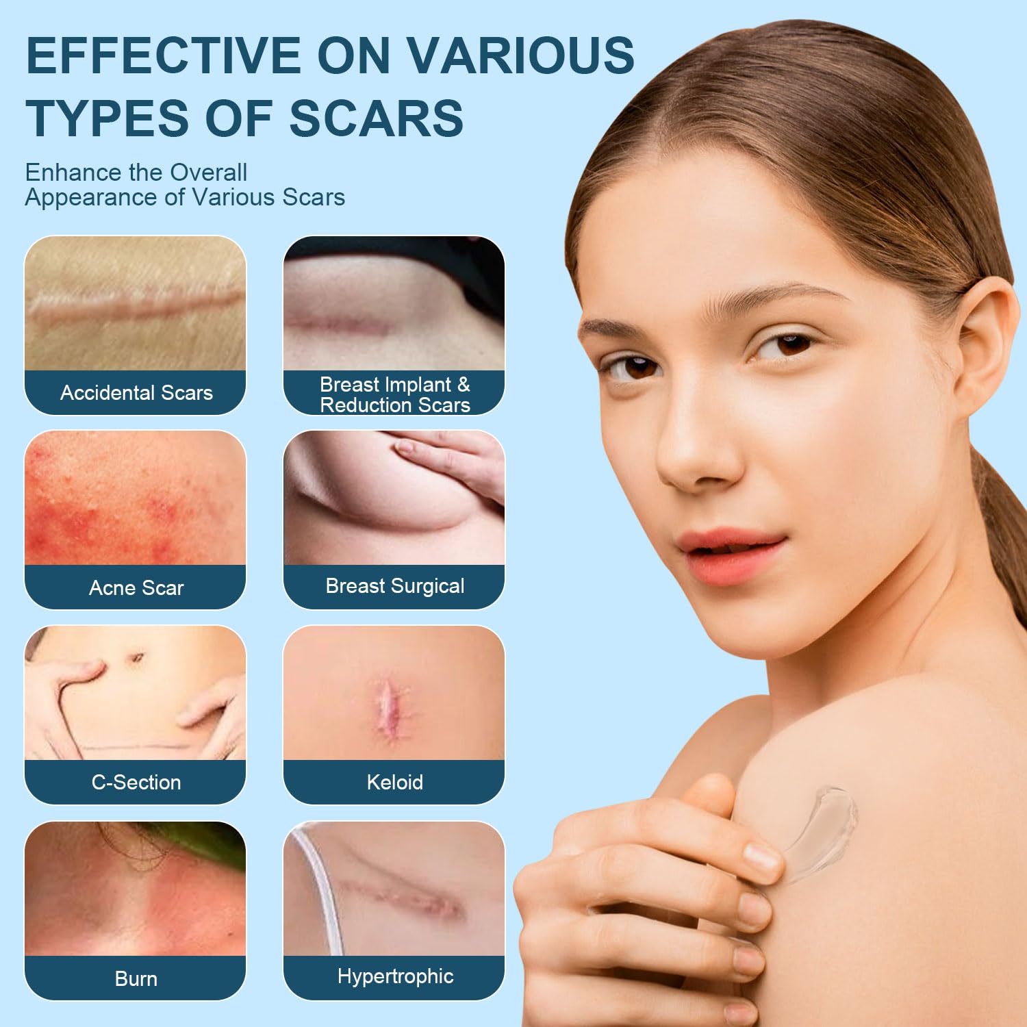Mitgary Advanced Scar Gel, Silicone Scar Gel, Treats Old and New Scars, Reduces the Appearance of Scars from, Body, Face, Stretch Marks, Surgical Scar, Keloids, Acne, Burns and More, 50g (1.7 Oz)