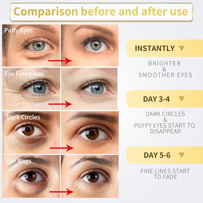 NAZANO 24K Gold Under Eye Patches - 60 Pack for Puffy Eyes, Dark Circles, Bags & Wrinkles with Collagen & Hyaluronic Acid - Eye Care Pads for Daily Skincare (Gold)